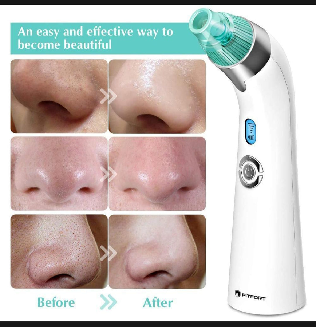 Bubble Vacuum Blackhead Remover – Deep Pore & Acne Cleaner with USB Rechargeable Suction for Oil & Impurities Removal