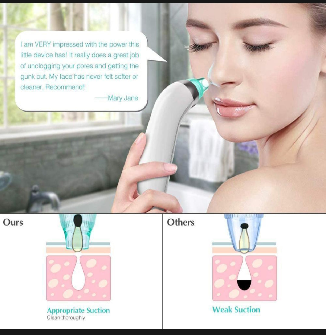 Bubble Vacuum Blackhead Remover – Deep Pore & Acne Cleaner with USB Rechargeable Suction for Oil & Impurities Removal