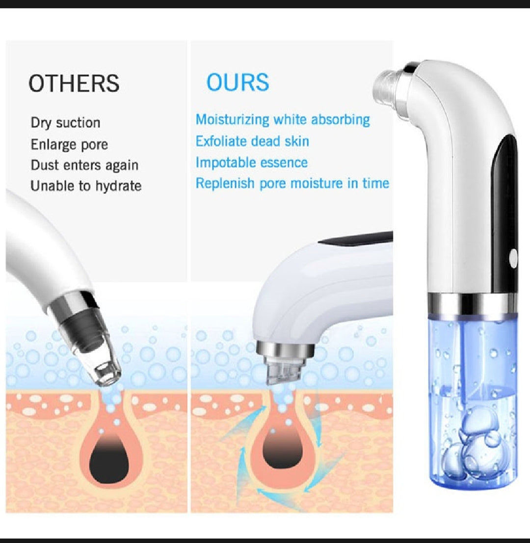 Bubble Vacuum Blackhead Remover – Deep Pore & Acne Cleaner with USB Rechargeable Suction for Oil & Impurities Removal